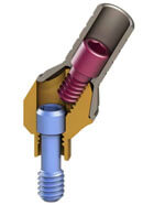 What is multi-unit abutment